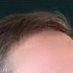 Zach Lowe’s Combover (@zachlowesmoptop) Twitter profile photo Zach Lowe’s Combover (@zachlowesmoptop) Twitter profile photo