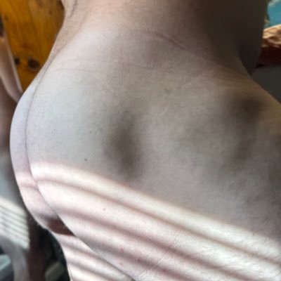 Need Help identifying, any recommendations for HRT? .. DM me please