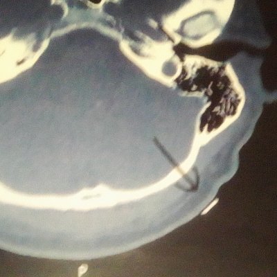 shivel32888's profile picture. I had a wonderful law abiding life before I went into surgery and was Implanted with BCI Brain Computer Interface. Then trafficked into Mkultra and Cointelpro