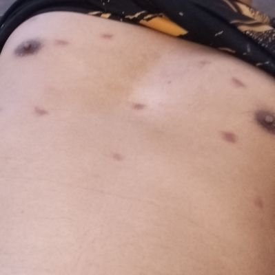 Tinggi, Slim, Berisi,
Vers T,
Tes HIV Gratis,
Melayani Sunat Dewasa dan Anak-anak Kota Semarang,
telegram.https://t.co/jcGCJeQH1l