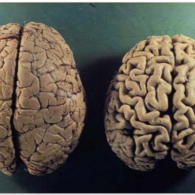 “Veedor profundo en la razón de las míseras humanas, debatiente…