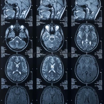 Neustudpoetry's profile picture. 