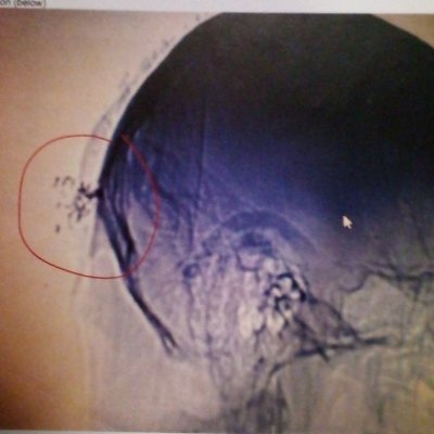 shivel42546's profile picture. Victim of Nonconsensual Experimentation for Mkultra Cointelpro Project, A Surveillance state Commodity and Human Target implanted 3/10/14  and Destroyed.