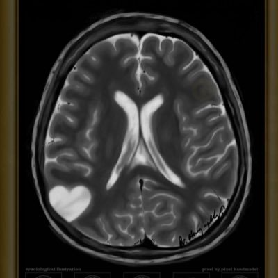 🌿{يرفع الله الذين آمنوا منكم والذين أوتوا العلم درجات}🌿 Neurology @KFMC_RIYADH, @_KSU alumna #439