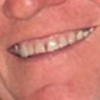 🗣 teeth (@tommytrip) 's Twitter Profile