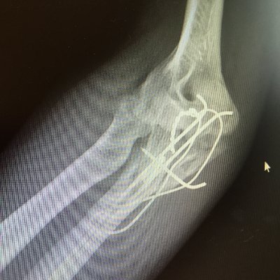 FriteCrakote's profile picture. 🇧🇪 

Slava Ukraini