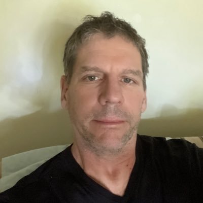 9-3-2017 BRYAN SCOTT REYNOLDS , TBI ,SPINAL STENOSIS PTSD
