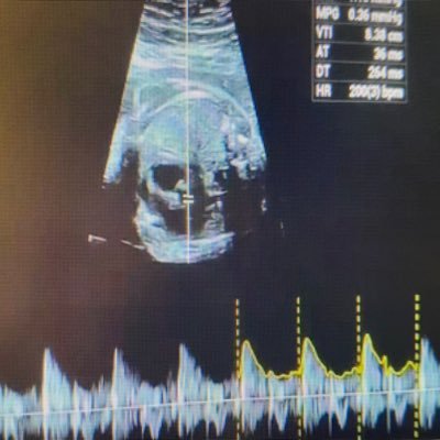 SancaktarA40628's profile picture. Pediatric cardiology, MD