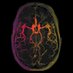 Ben (@ben_bsv_md) Twitter profile photo Ben (@ben_bsv_md) Twitter profile photo