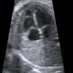 Radiologia (@256_shadesofgry) Twitter profile photo Radiologia (@256_shadesofgry) Twitter profile photo