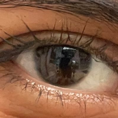 CascoDeQueso's profile picture. Catarino otorrinolaringólogo