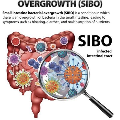 JonMorrow7's profile picture. SIBO campaigner. Why won’t the NHS listen?