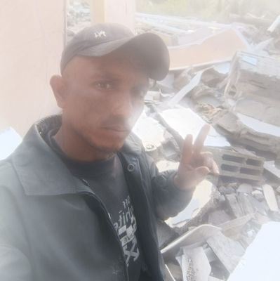 Nael Yousef from Gaza. My house was bombed and my family and I were injured. I have a child who was seriously injured and needs surgery, and I have burns all ov
