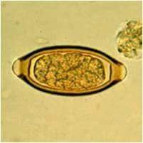 PARASITOLOGÍA MÉDICA UNERG VALLE DE LA PASCUA.