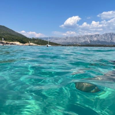 η υπομονή μου είναι αρκετή αλλά όχι αστείρευτη, ξυνουμπα , αλλά όχι κάθε μέρα