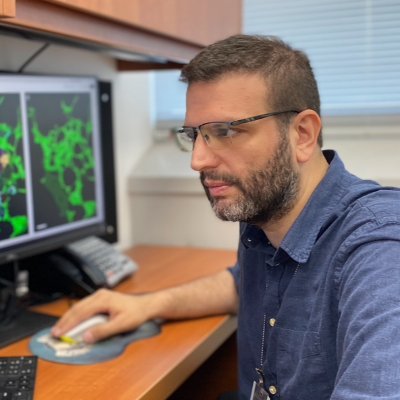 We study the response of the immune and tumor microenvironments to cytotoxic chemotherapies/stressors using advanced microscopy and digital pathology.