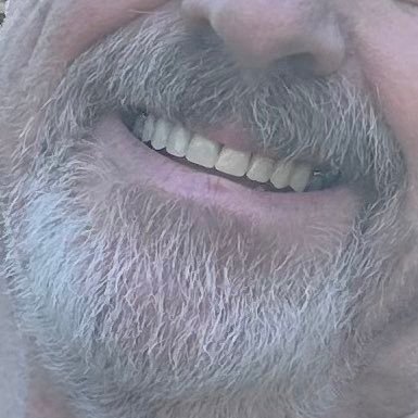 Scotland 🏴 With age comes kink….vers top into all things anal, man smells, smeg, love to FF, prefer uncut & love G:Holes. No women or under 18.
