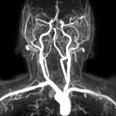 TraderBD1's profile picture. #Trader #Bitcoin #Dollar | Burası benim trade günlüğüm, yatırım tavsiyesi vermiyorum. | Unemotional towards money markets…