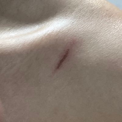 ssibal5guangtal's profile picture. 장애인