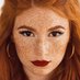Red hairy (@alonsopig13) Twitter profile photo Red hairy (@alonsopig13) Twitter profile photo