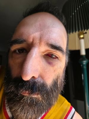 RobbyRoad12's profile picture. Help me with my Eye Surgery Recovery