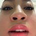 jan, fRMT, fMD (@janrmtmd) Twitter profile photo jan, fRMT, fMD (@janrmtmd) Twitter profile photo