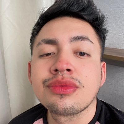 24años 🏳️🌈🍑🔞 morbo a full PUTO LISIADO en busca de verga y leche de nuevo ♿️🍆💦propuestas al DM