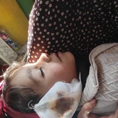 Help us save my baby and keep her alive🙏🙏
https://t.co/7qzez77BVu
