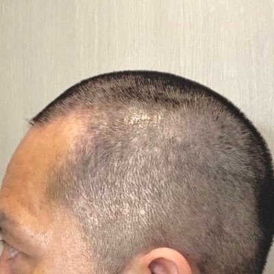 #ドレッドヘアにショートパンツのこの男性 当時 / 🏀鹿児島レブナイズ当時CCO/KYT30周年ブランディング/鹿児島銀行(よかど鹿児島)空間演出/鹿児島音声コンテンツ「島ズ」スタート📻