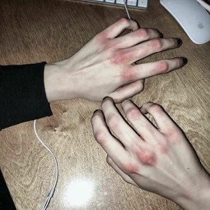 mentally ill girl š§š»āāļø | 24 years