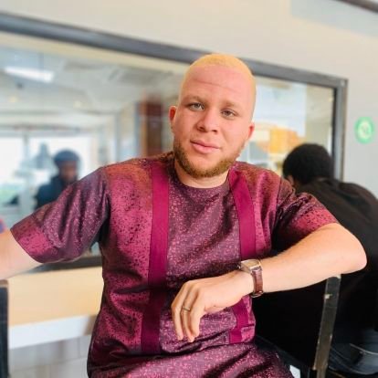 Dad, Screenwriter, Filmmaker, Talks About Albinism, Chelsea Fan.