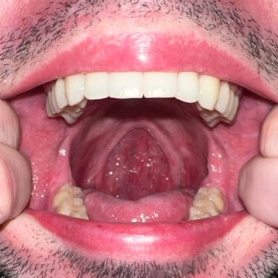 GoonerSlutFag's profile picture. its a FF faggot hole. 🕳️ looking for surgeons who can help me get professional procedures, surgery and advice to rearrange its dick and balls. Whether…