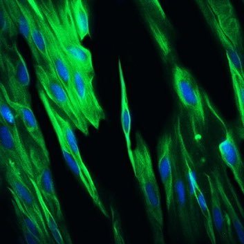 PhD in Tissue Engineering and Regenerative Medicine (TUMS) #Tissue_engineering #Regenerative_medicine #Biomedical_engineering #Stem_cell #Hydrogel #Biomaterial
