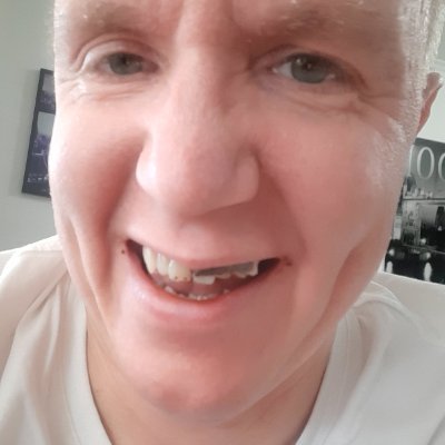 Learning too embrace the rejection besauce its my only choise as an ugly beta. 18 plus only!