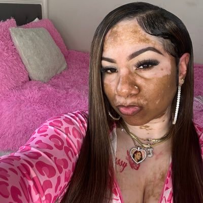 The Vitiligo Mami 🤍 LA 📍 #LLT5 🫶🏽 Instagram: IamJhanae 🥰