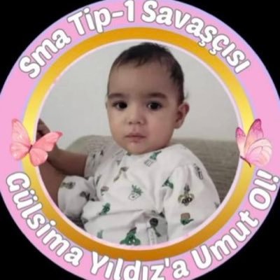 Gülsima SMA Tip-1 ölümcül kas hastası. Valilik onaylıdır. (FALİYET NO: 34.2025.3321 TUĞÇE YILDIZ) Tüm bağış kanallarımıza Taplink üzerinden ulaşabilirsiniz.⬇️