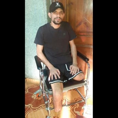 Hello, my friends, I have had both legs amputated. My dream is to walk again with prosthetic limbs. I hope you can help me and share the link to my campaign.🤍