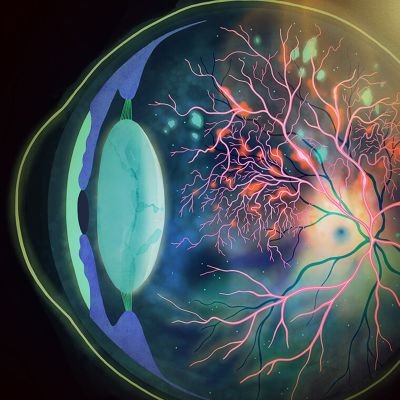 Ashutos24211986's profile picture. ⚕️OPHTHALMIC OFFICER 
@medicalmkcg
@SCBMCHCTC