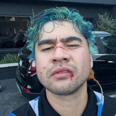 zw0iku's profile picture. 22  free palestine 🍉 🇵🇸 5sos fanart ☆