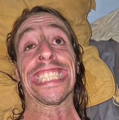 cojon peludo de los que si hace calor sudan y te puedes tomar un vasito de jugo