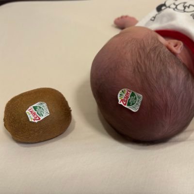 qoill8's profile picture. ²⁰⁰³（𝟤𝟣）︴²⁰²⁵ 3ᴍ ʙᴀʙʏ .⋆𝜗𝜚