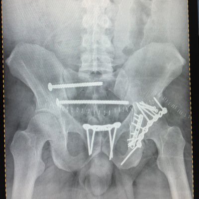 FlipMrktFixBone's profile picture. M.D.  Orthopaedic Trauma Surgeon. Fixing broken humans and broken financial systems.
