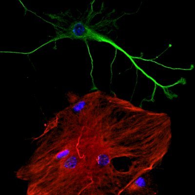 Tf4Synapse's profile picture. PhD in Neural Interfaces | Discussing neuroscience, neurotech & neurocognition | Sharing insights & research