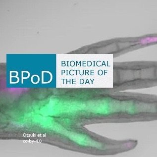 @BPoD_s
