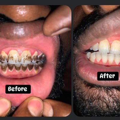 sogheer's profile picture. GDBV ADVOCATE, DENTIST, CYBER PRO. (Plant a tree today)