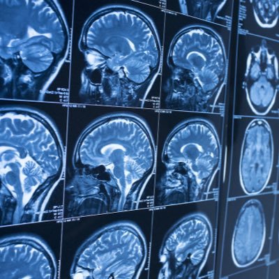 NeuroFrontiersX's profile picture. Curating breakthroughs in brain–computer interfaces, neuroengineering, and artificial intelligence — advancing the science of the mind. 🧠🤖