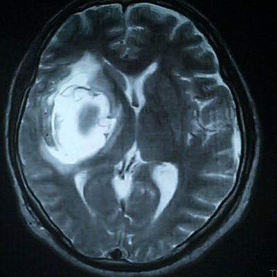 napponnorousai's profile picture. 届け！
限界を超え続けることを努力と呼んではいけません。
今こそ行動するのです。大切な人と、自分自身の為に。
#労災 #過労死ライン