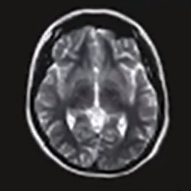 fmiraneuro's profile picture. 