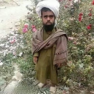 NAhmadzi68682's profile picture. نوی ایکاونټ می فعال کړی فالو می کړی
 
ملاهلمندی دملاګرنیټ مرید