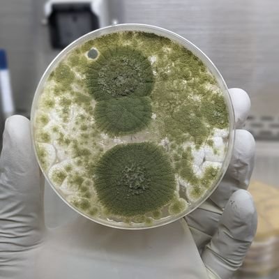 AkyooJonathan's profile picture. 🇹🇿 Medical Laboratory Technologist
NTDs researcher (Onchocerciasis and Lymphatic filariasis)